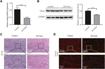 Identification and characterization of novel elastin gene mutations in eleven families with supravalvular aortic stenosis